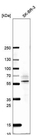 Western blot analysis in human cell line SK-BR-3.