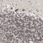 Immunohistochemical staining of human cerebellum shows moderate cytoplasmic positivity in Purkinje cells.