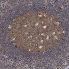 Immunohistochemical staining of human lymphoid tissues shows moderate cytoplasmic positivity in germinal center cells.