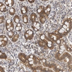 Immunohistochemical staining of human gastrointestinal shows moderate cytoplasmic positivity in glandular cells.