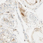 Immunohistochemical staining of human testis shows moderate cytoplasmic positivity in Leydig cells.