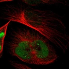 Immunofluorescent staining of human cell line U-251 MG shows localization to nucleoplasm.