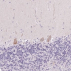 Immunohistochemical staining of human cerebellum shows moderate cytoplasmic positivity in Purkinje cells.