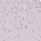 Immunohistochemical staining of human cerebral cortex shows moderate cytoplasmic positivity in subset of neuronal cells.