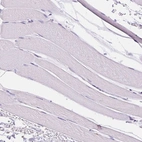 Immunohistochemical staining of human skeletal muscle shows no positivity in myocytes as expected.