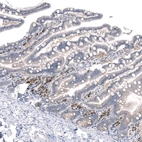 Immunohistochemical staining of human duodenum shows strong nuclear positivity in lymphoid cells.