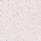 Immunohistochemical staining of human cerebral cortex shows no nuclear positivity in neurons as expected.