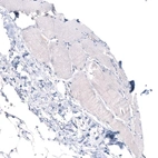 Immunohistochemical staining of human skeletal muscle shows no nuclear positivity in myocytes as expected.