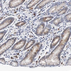 Immunohistochemical staining of human stomach shows moderate membranous positivity in glandular cells.