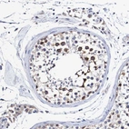 Immunohistochemical staining of human testis shows strong positivity in nuclear membrane in cells in seminiferous ducts.