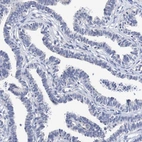 Immunohistochemical staining of human fallopian tube shows no positivity in glandular cells.