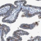 Immunohistochemical staining of human fallopian tube shows moderate cytoplasmic-membranous positivity in glandular cells.