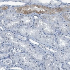 Immunohistochemical staining of human kidney shows moderate cytoplasmic positivity in cells in tubules.