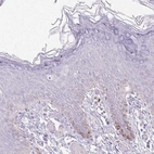 Immunohistochemical staining of human skin shows moderate cytoplasmic membranous positivity in subset of squamous epithelial cells.