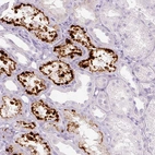 Immunohistochemical staining of human kidney shows strong cytoplasmic/cytoplasmic granular positivity in subset of cells in tubules.