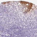 Immunohistochemical staining of human tonsil tissues shows strong cytoplasmic positivity in blood vessels.