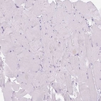 Immunohistochemical staining of human skeletal muscle shows no positivity in myocytes as expected.