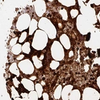 Immunohistochemical staining of human bone marrow shows strong cytoplasmic positivity in hematopoietic cells.