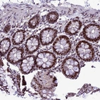 Immunohistochemical staining of human colon shows strong nuclear positivity in glandular cells.