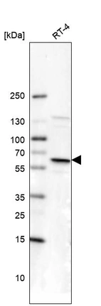 Western blot analysis in human cell line RT-4.