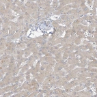 Immunohistochemical staining of human liver shows weak cytoplasmic positivity in hepatocytes.