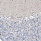 Immunohistochemical staining of human cerebellum shows no positivity in Purkinje cells.
