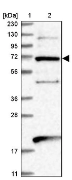 Lane 1: Marker [kDa] 230, 130, 95, 72, 56, 36, 28, 17, 11_br/_Lane 2: Human cell line RT-4