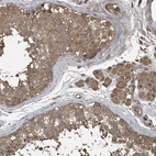 Immunohistochemical staining of human testis shows moderate cytoplasmic positivity in cells in seminiferous ducts.