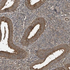 Immunohistochemical staining of human endometrium shows moderate cytoplasmic positivity in glandular cells.