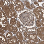 Immunohistochemical staining of human kidney shows moderate cytoplasmic positivity in cells in tubules.