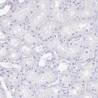 Immunohistochemical staining of human kidney shows no positivity in cells in tubules as expected.