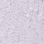 Immunohistochemical staining of human skeletal muscle shows no positivity in myocytes as expected.