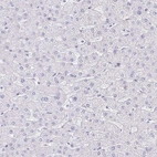 Immunohistochemical staining of human liver shows no cytoplasmic positivity in hepatocytes as expected.