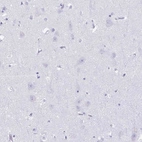 Immunohistochemical staining of human cerebral cortex shows no cytoplasmic positivity in neuronal cells as expected.