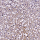 Immunohistochemical staining of human liver shows moderate cytoplasmic positivity in subset of hepatocytes.