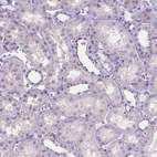 Immunohistochemical staining of human kidney shows no positivity in cells in tubules as expected.