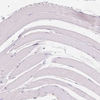 Immunohistochemical staining of human skeletal muscle shows no positivity in myocytes as expected.