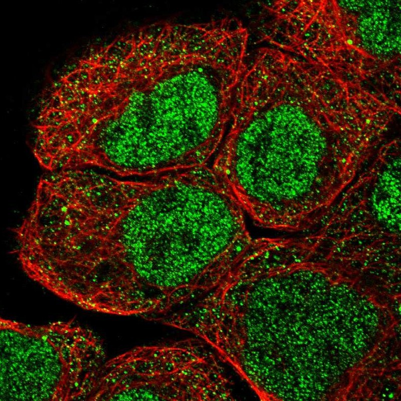 Anti-RLIM Antibody
