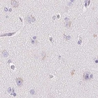 Immunohistochemical staining of human cerebral cortex using Anti-KCNE2 antibody HPA029706.