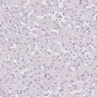 Immunohistochemical staining of human liver shows no membranous positivity in hepatocytes as expected.