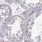 Immunohistochemical staining of human testis shows weak nuclear positivity in Leydig cells and in cells in seminiferous ducts.