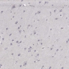Immunohistochemical staining of human cerebral cortex shows no nuclear positivity in glial cells.