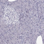 Immunohistochemical staining of human pancreas shows no positivity in exocrine glandular cells as expected.