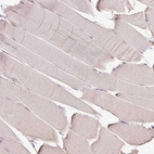 Immunohistochemical staining of human skeletal muscle shows very weak positivity in myocytes.