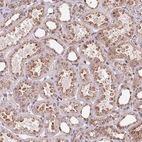 Immunohistochemical staining of human kidney shows strong positivity in cytoplasm granular in cells in tubules.