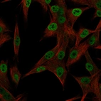 Immunofluorescent staining of the human cell line SK-MEL-30 using Anti‑HLX antibody HPA005968, showing protein localization to the nucleoplasm (green). Microtubules and nuclei are visualized in red and blue, respectively (where applicable).