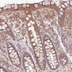 Immunohistochemical staining of human gastrointestinal shows moderate cytoplasmic positivity in glandular cells.