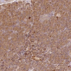 Immunohistochemical staining of human pancreas shows moderate cytoplasmic positivity in exocrine glandular cells.