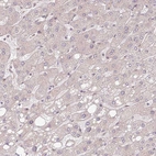 Immunohistochemical staining of human liver shows no positivity in hepatocytes.