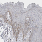 Immunohistochemical staining of human skin shows weak cytoplasmic positivity in subset of squamous epithelial cells.